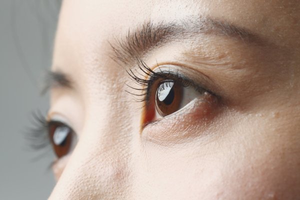 Close-up of clear, healthy eyes, representing success after ICL lens implant surgery